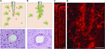 Finite Element Modeling of Magnitude and Location of Brain Micromotion Induced Strain for Intracortical Implants